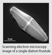 Scanning electron microscopy  image of a single diatom frustule.